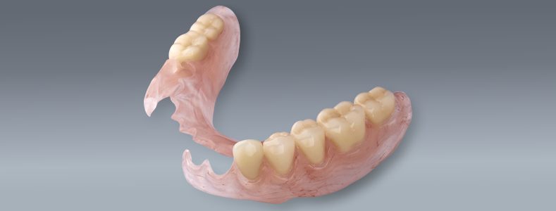 flexible partial dentures for back teeth