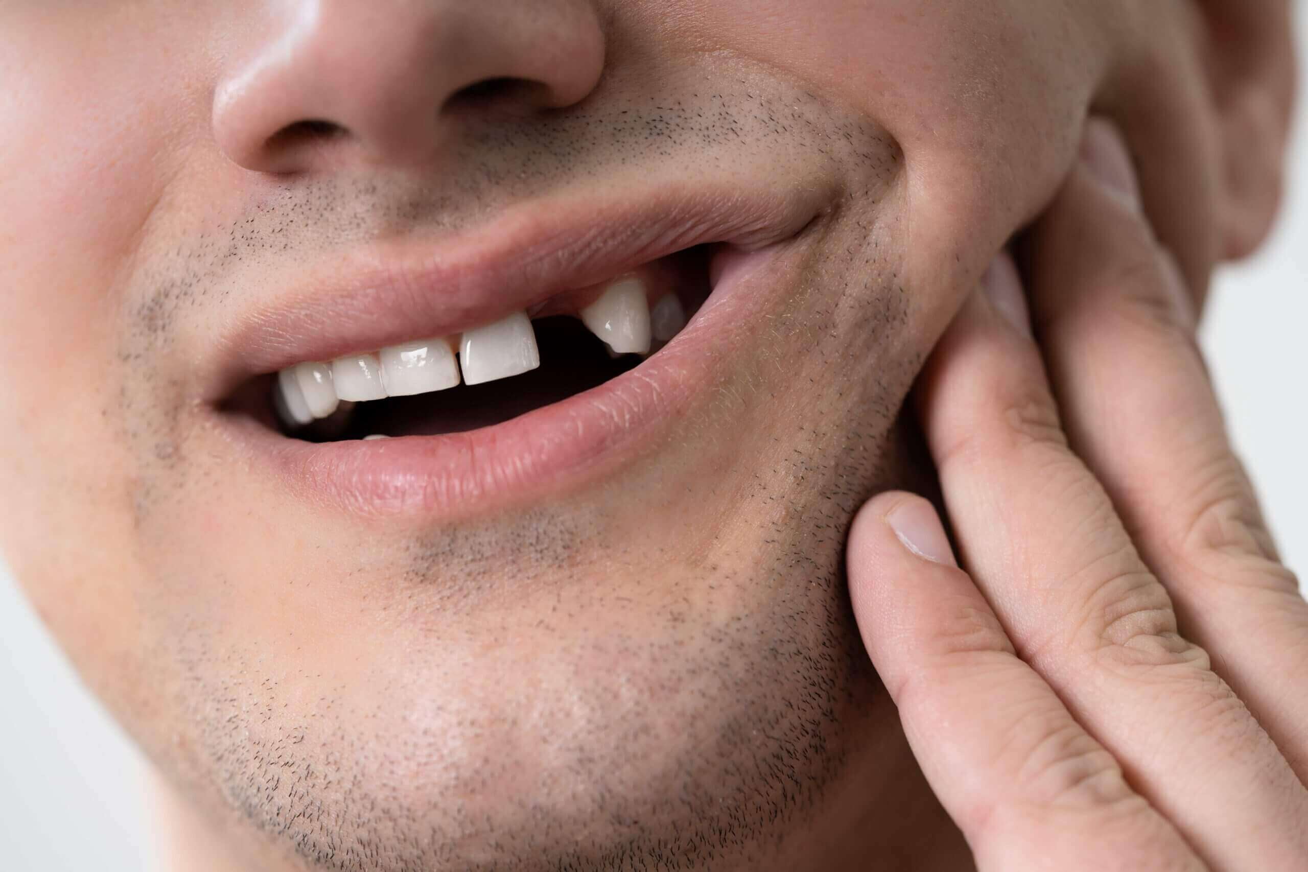 Front Tooth Replacement Options: A Comprehensive Guide