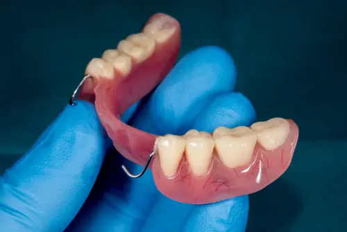 Partial Dentures for Back Teeth