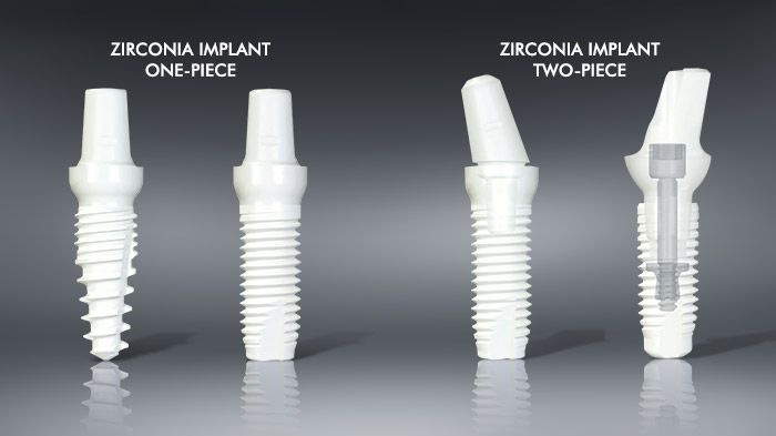 Cosmetic dental implants provide a permanent solution for missing teeth.