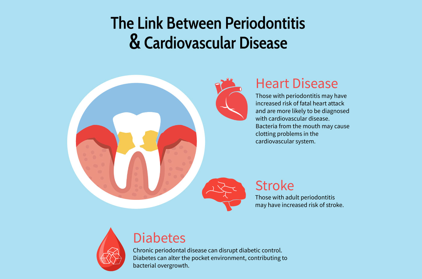 Dental Decay and Heart Disease: An In-Depth Exploration