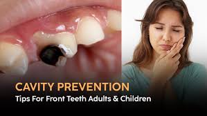 how to prevent dental decay
