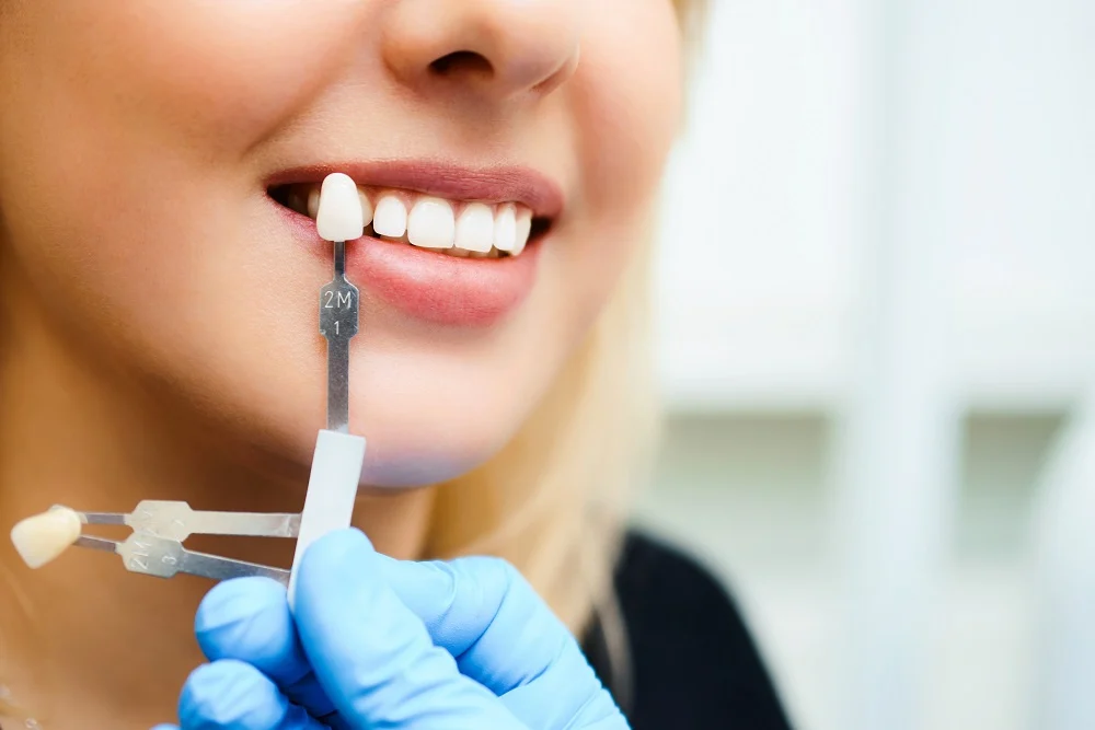 permanent artificial teeth