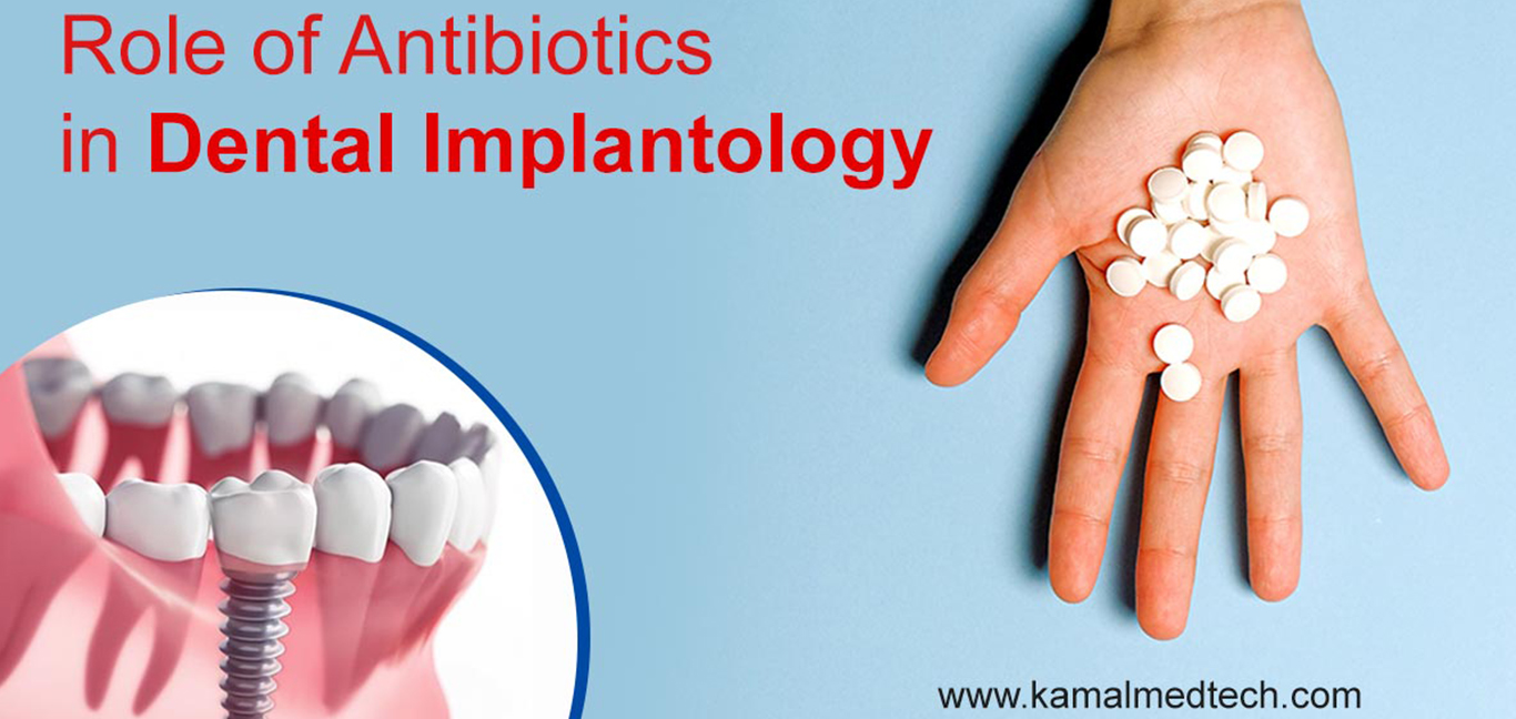 how long should i take antibiotics after dental implant