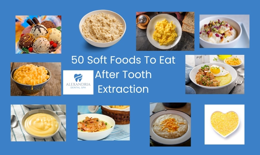 50 soft foods to eat after tooth extraction