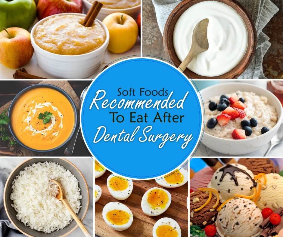 50 soft foods to eat after tooth extraction