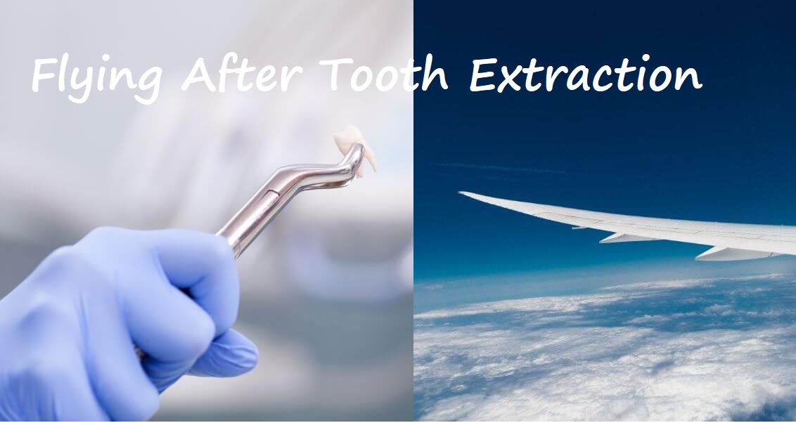 Flying After Tooth Extraction