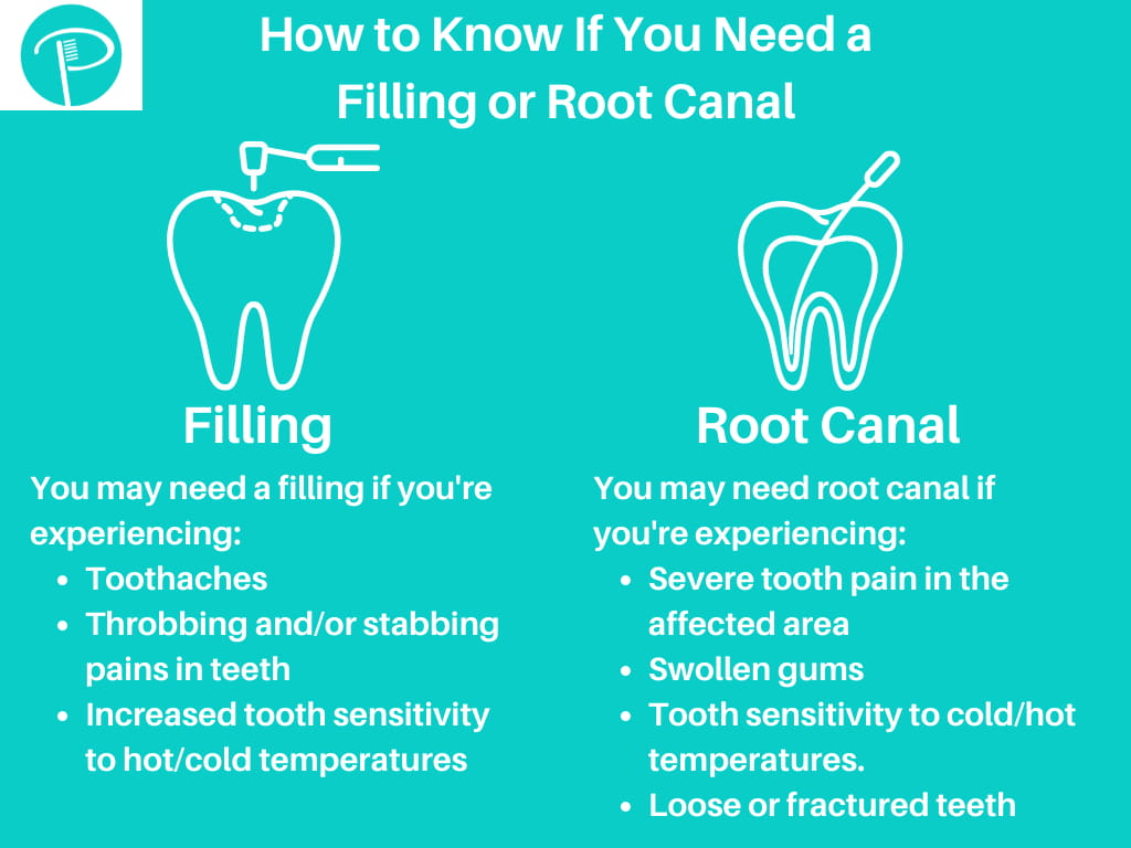 How Do I Know If I Need a Root Canal or a Filling