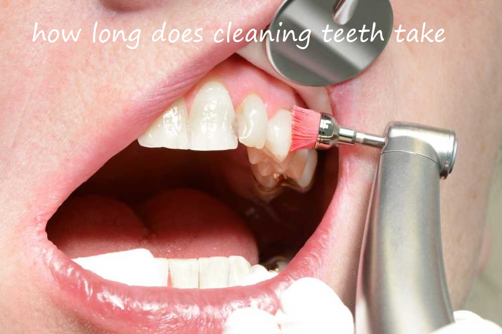 how long does cleaning teeth take