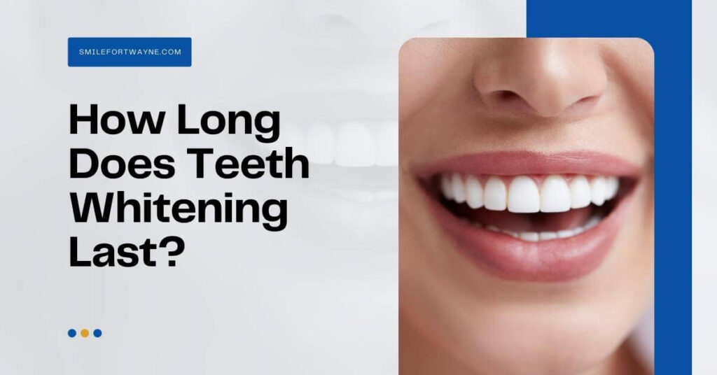 how long does teeth whitening last