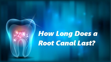 How Long Does a Root Canal Last