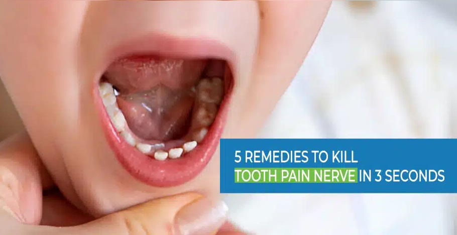 kill tooth pain nerve in 3 seconds permanently