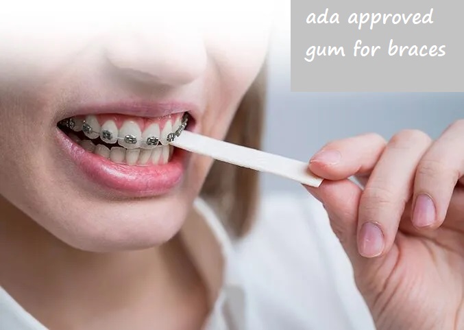 ada approved gum for braces