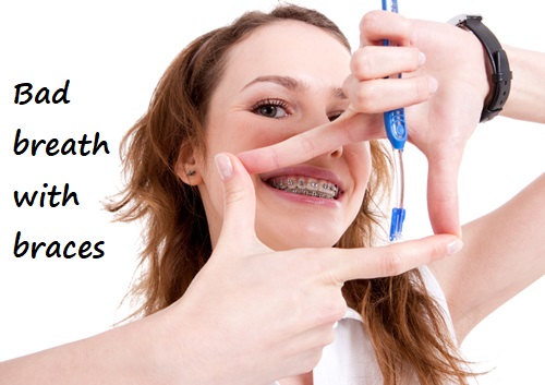 bad breath with braces