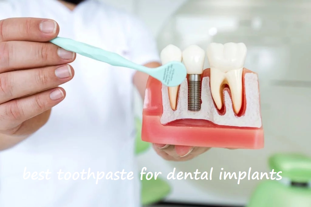 best toothpaste for dental implants