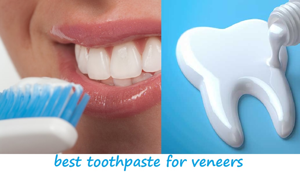 best toothpaste for veneers