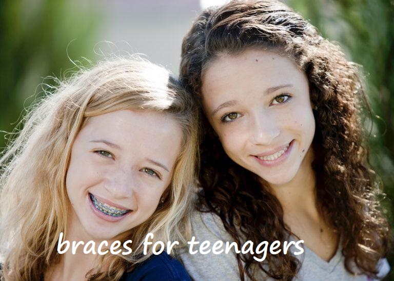 braces for teenagers