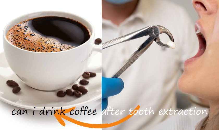 can i drink coffee after tooth extraction