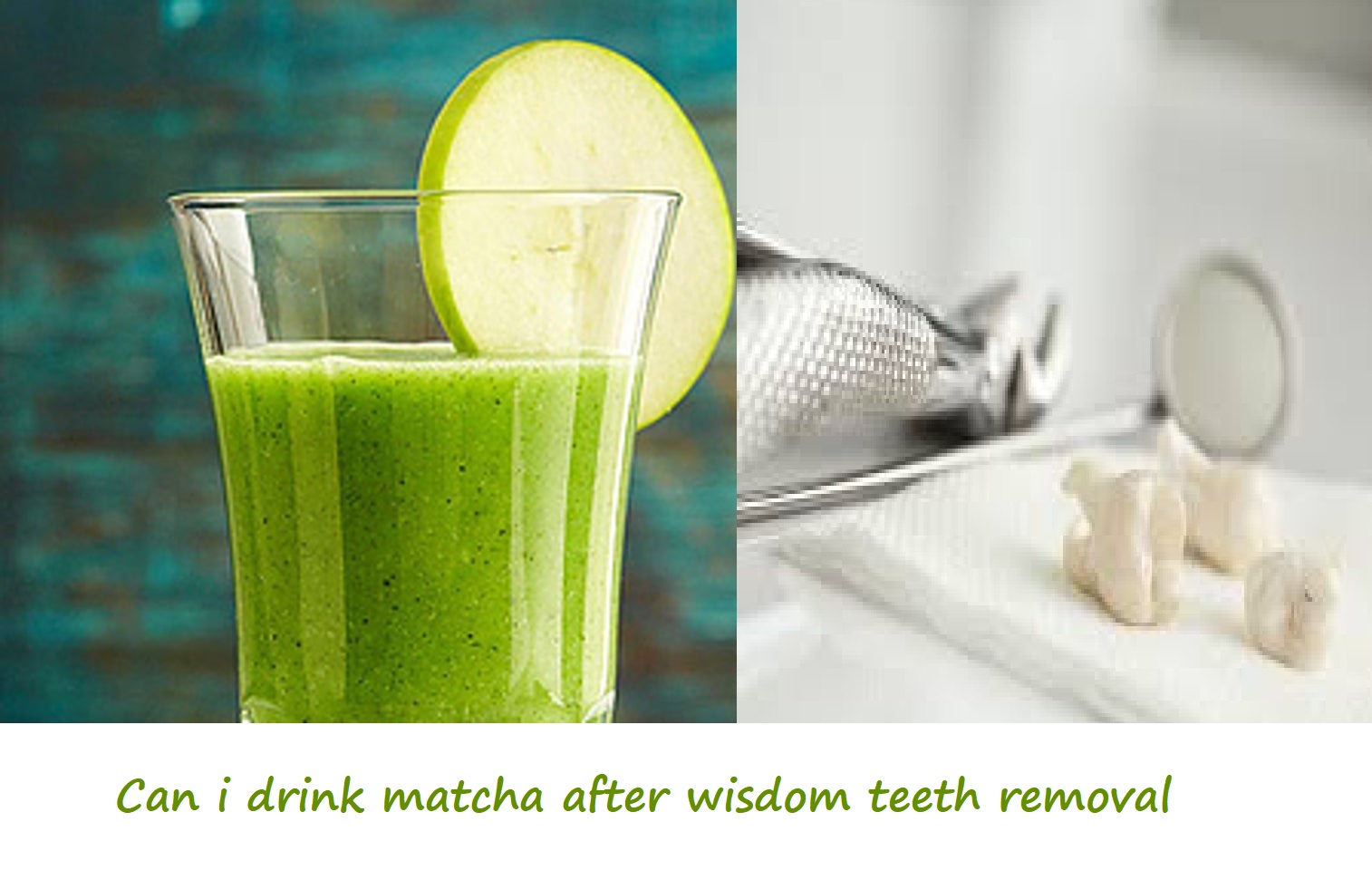 can i drink matcha after wisdom teeth removal