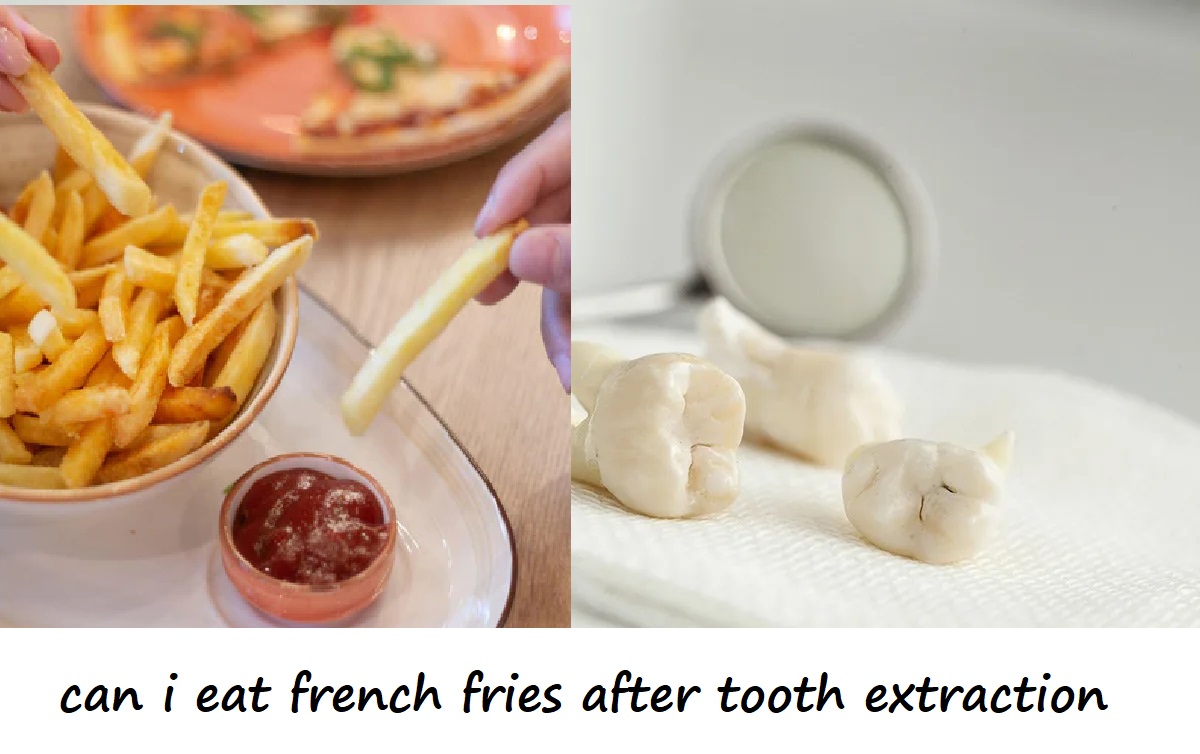 can i eat french fries after tooth extraction