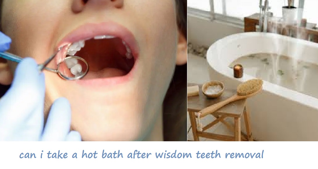 can i take a hot bath after wisdom teeth removal