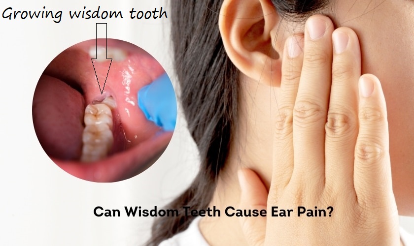 can wisdom teeth cause ear pain