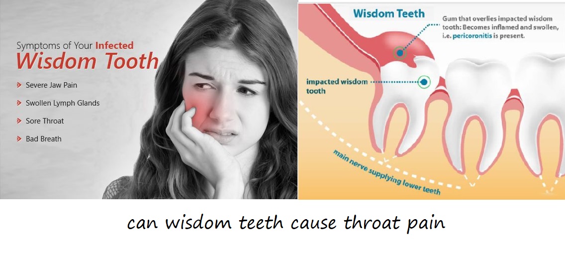 can wisdom teeth cause throat pain