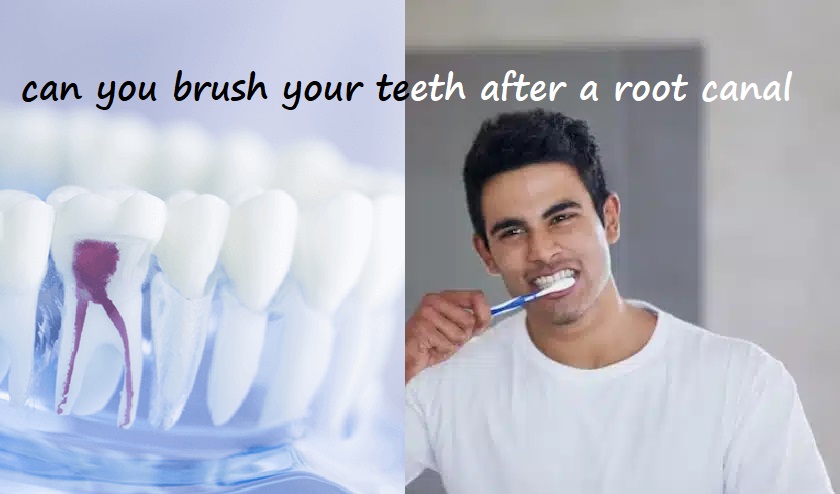 can you brush your teeth after a root canal