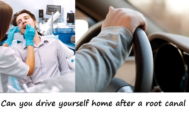 can you drive yourself home after a root canal