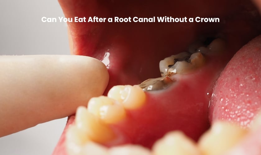 what to eat after root canal before crown