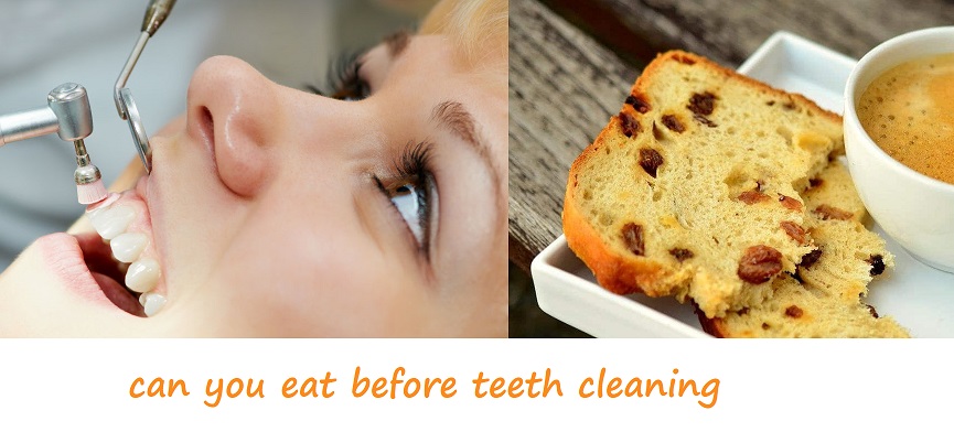 can you eat before teeth cleaning