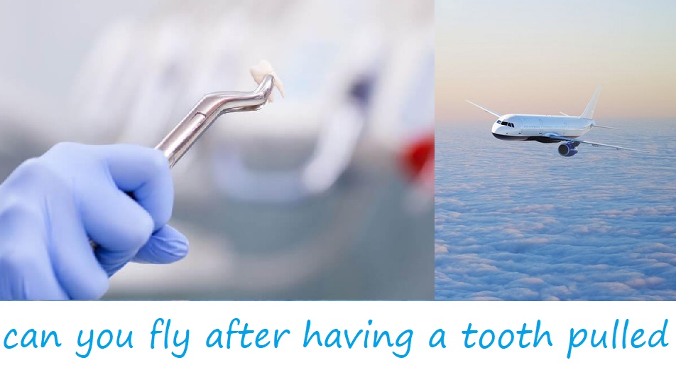 can you fly after having a tooth pulled