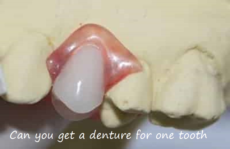 can you get a denture for one tooth