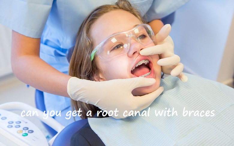 can you get a root canal with braces