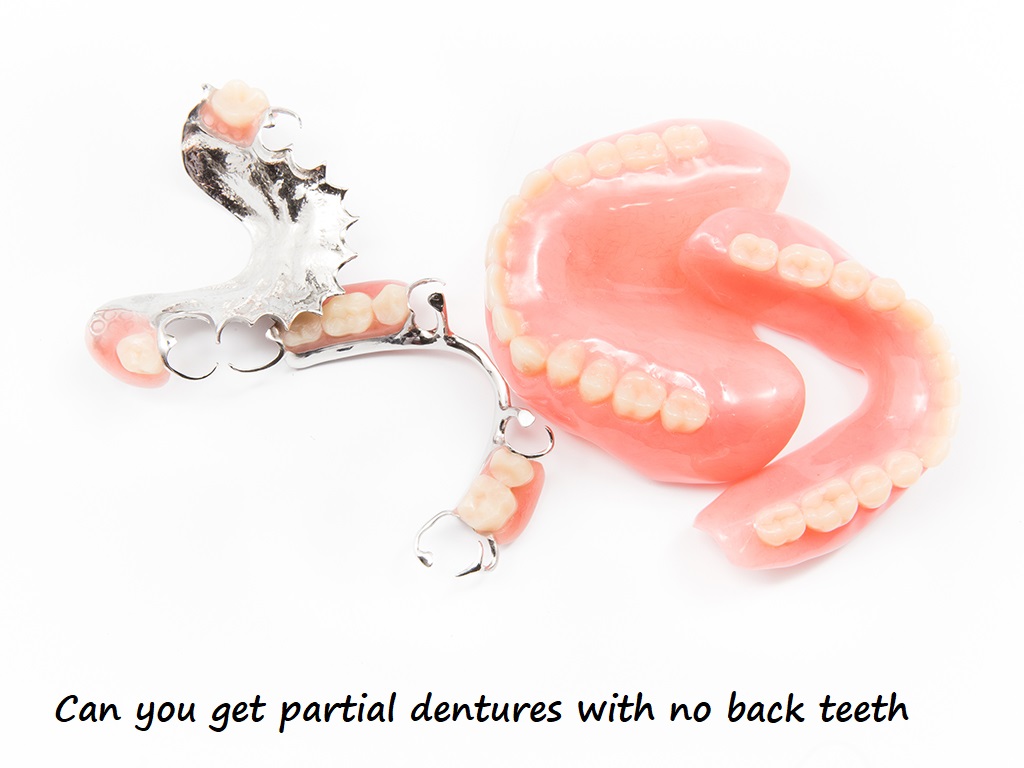 can you get partial dentures with no back teeth