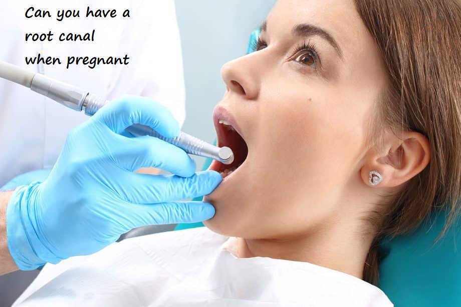 can you have a root canal when pregnant