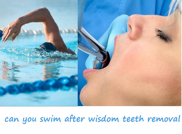 can you swim after wisdom teeth removal