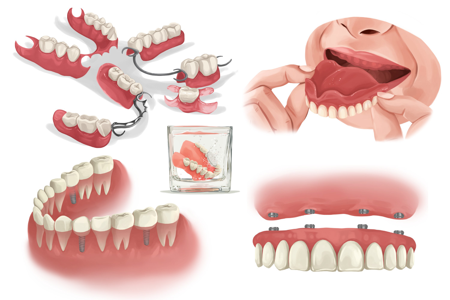 Cheap Options for Missing Teeth