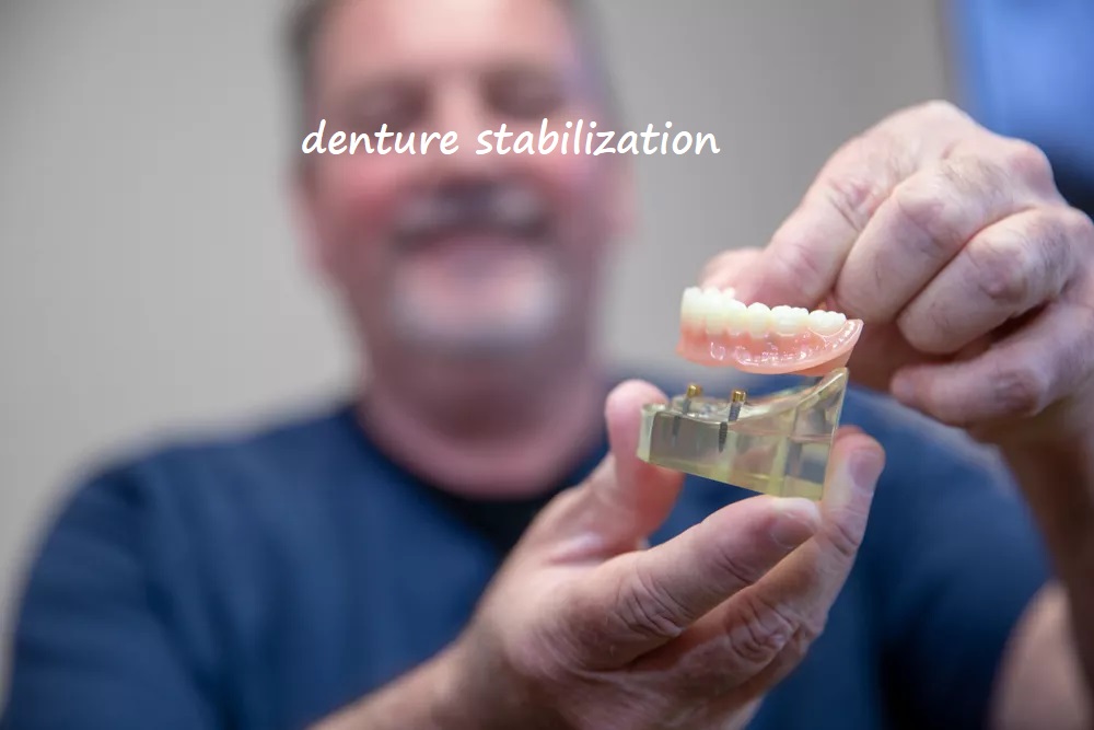 denture stabilization