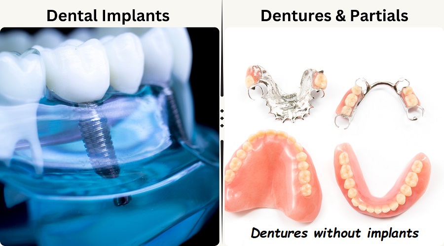 Dentures without implants