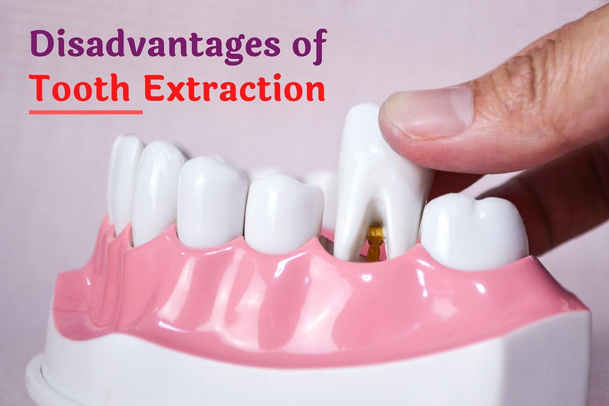 disadvantages of tooth extraction