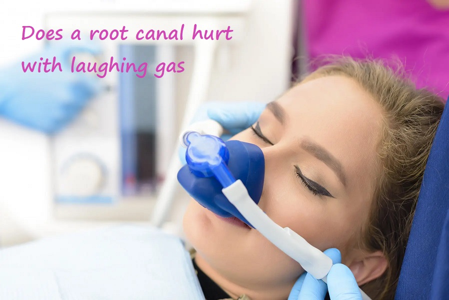 does a root canal hurt with laughing gas