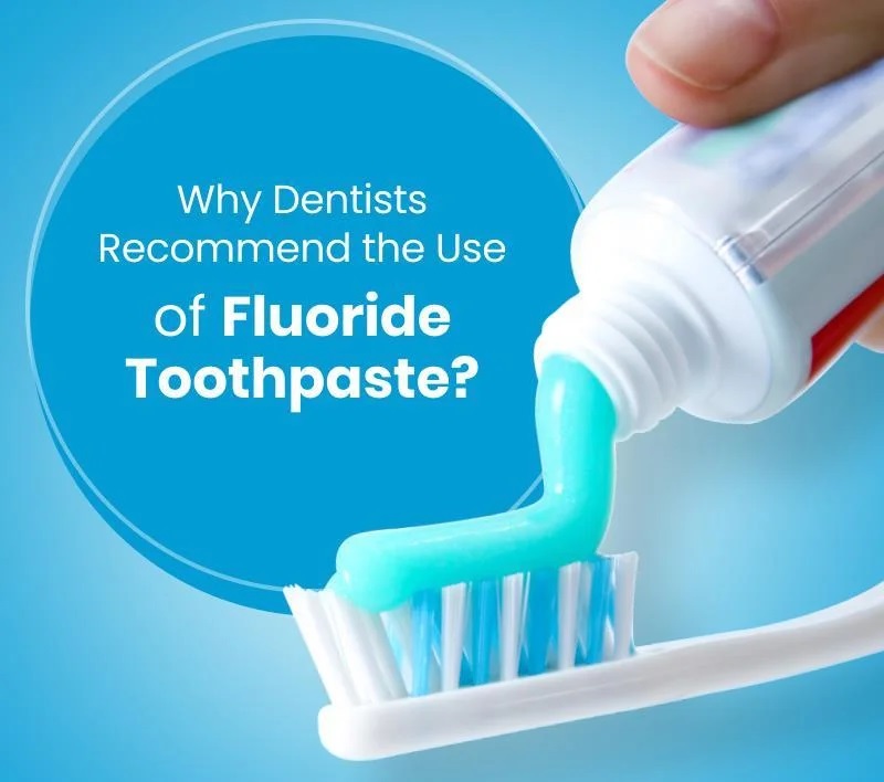 Fluoride Toothpaste