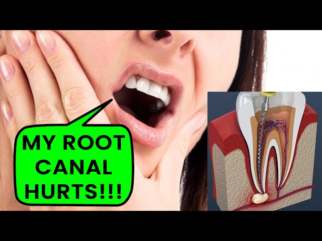 how long does root canal pain last