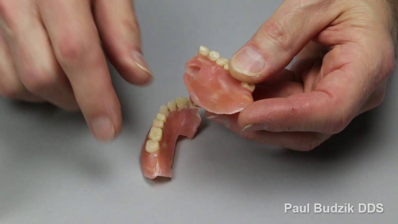 how to fix a broken denture tooth at home