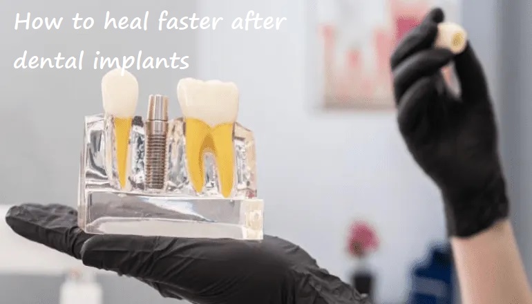 how to heal faster after dental implants