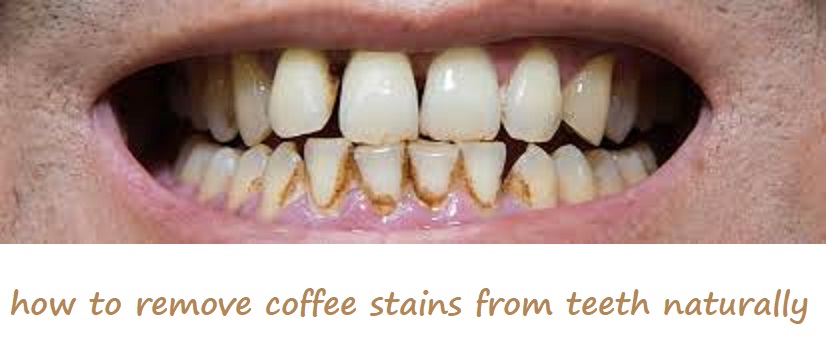 how to remove coffee stains from teeth naturally