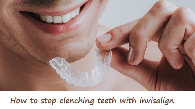 how to stop clenching teeth with invisalign