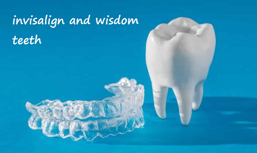 invisalign and wisdom teeth