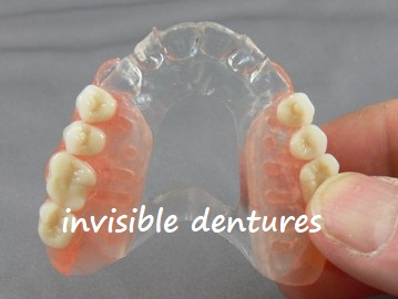 invisible dentures